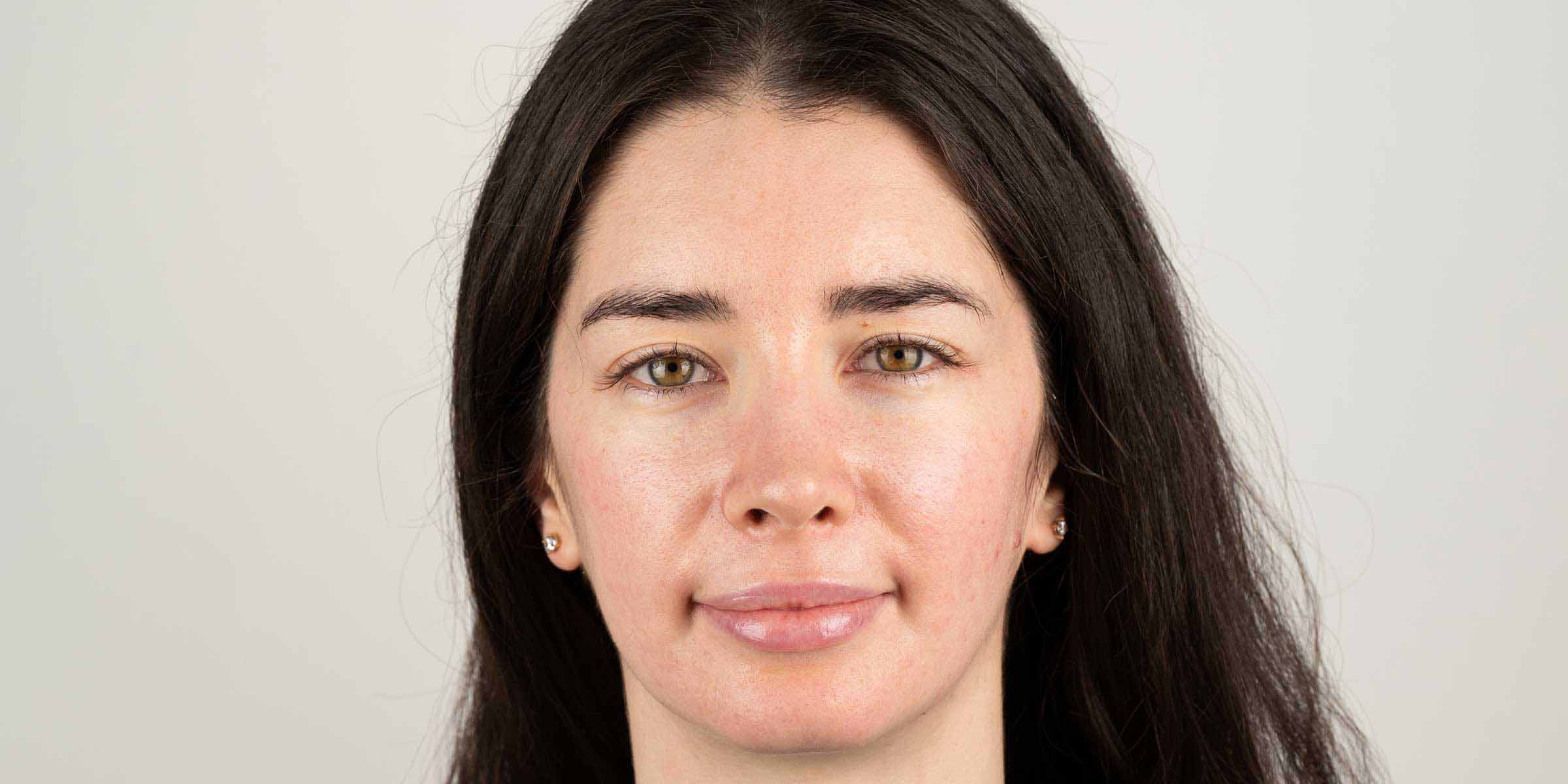 резултат след употреба на серум за лице rose hydrobiome