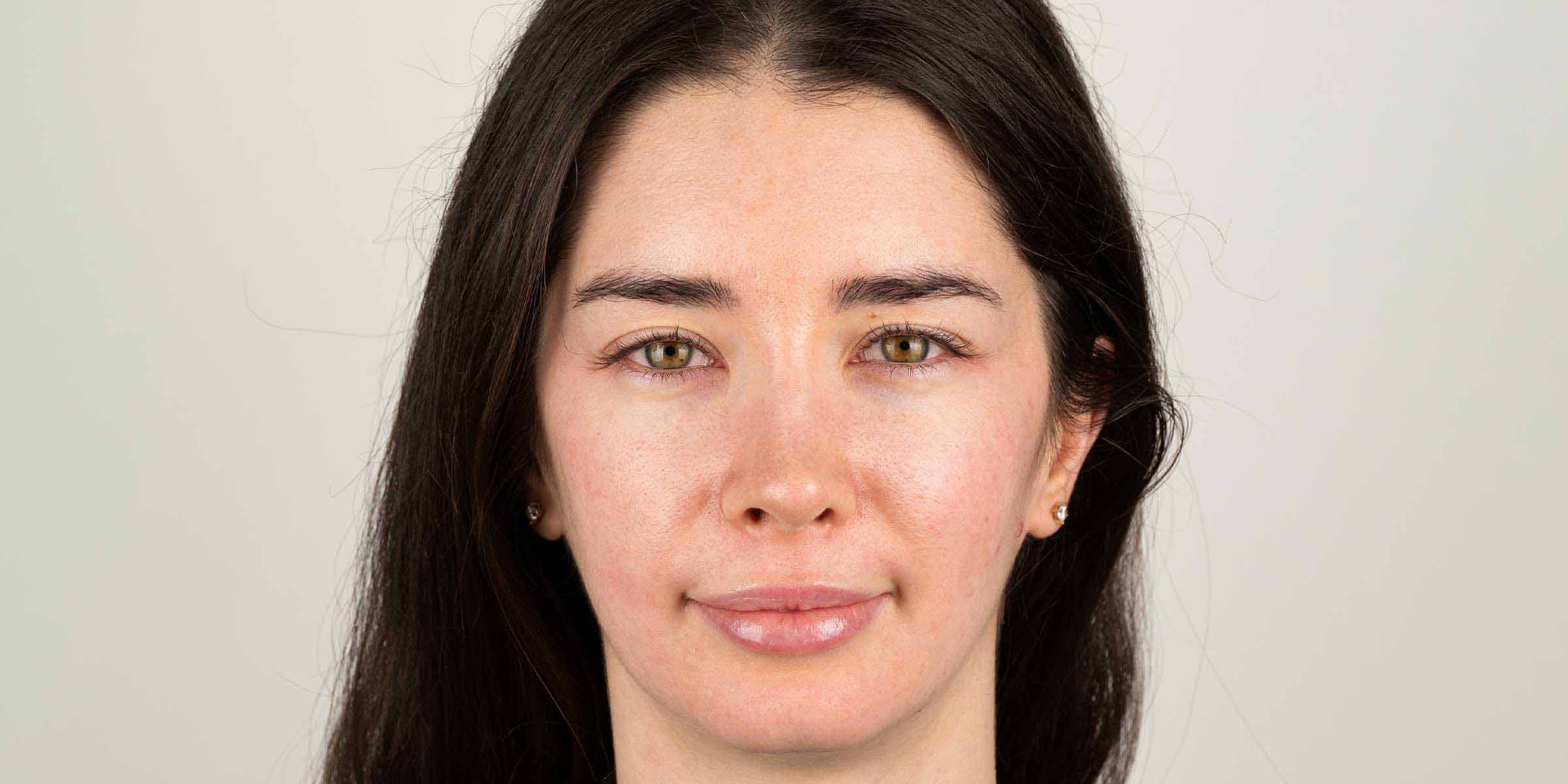 резултата от преди прилагане на серум за лице