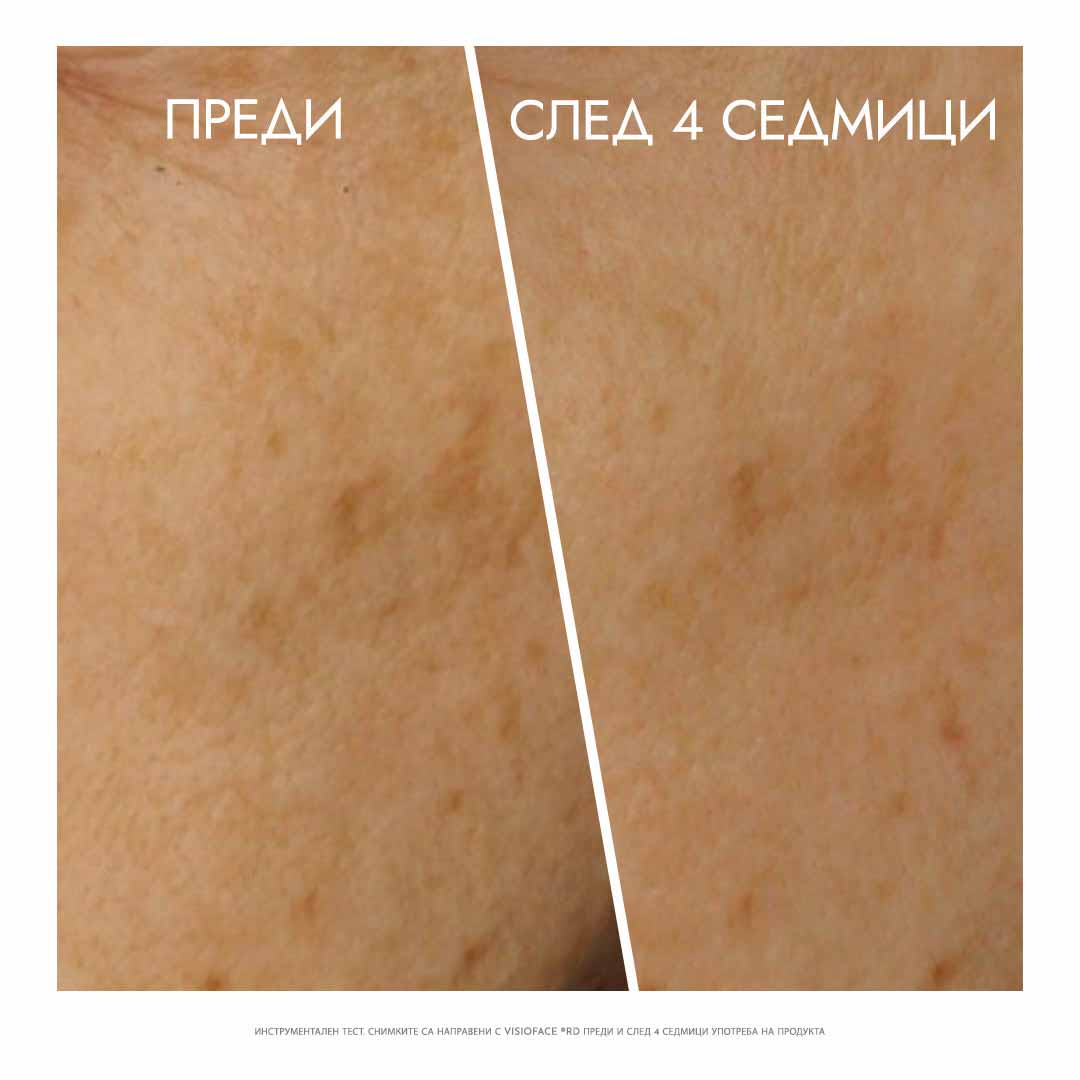 озаряващ сурум за лице преди и след употрема