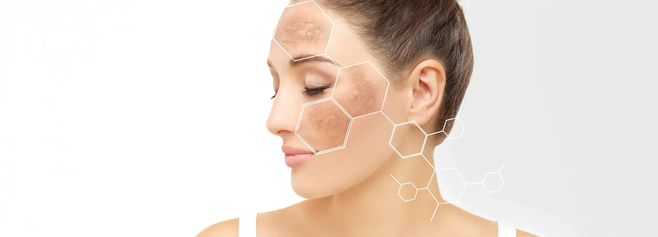 Как да се отървете от петната по кожата desktop